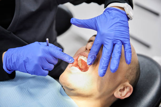 Best Chipped Tooth Repair Near Me  in Nashwauk, MN